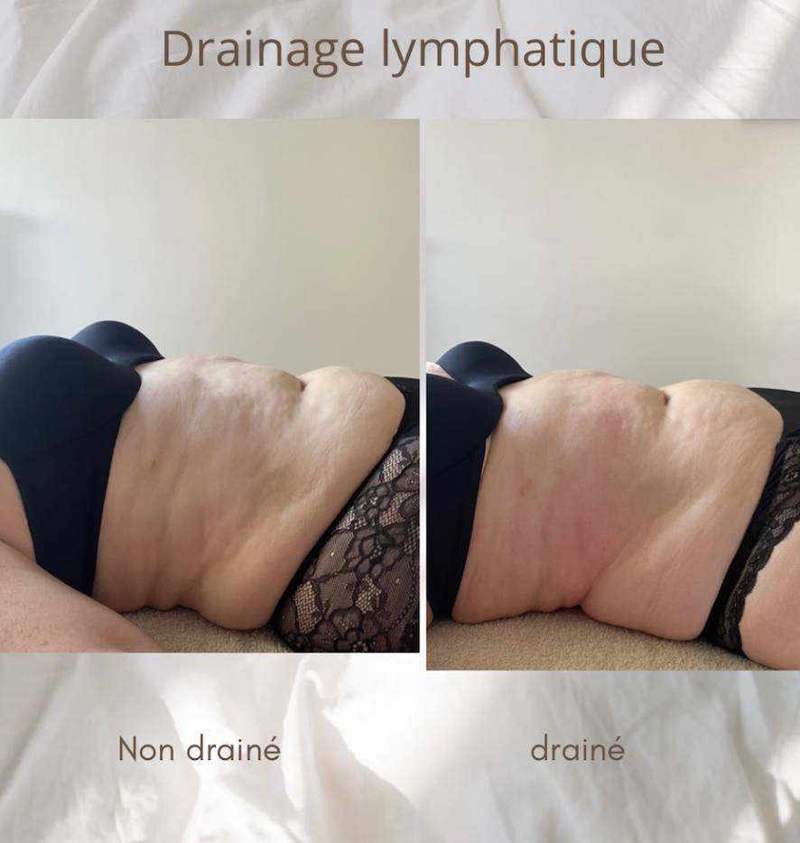 Massage drainant Annemasse-Reignier